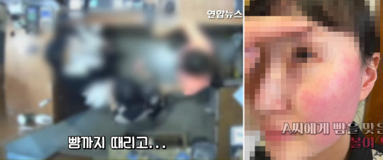 폭행 혐의로 경찰 조사를 받고 있는 주한 벨기에 대사 부인에게 뺨을 맞은 피해자인 옷가게 점원과 가족이 볼이 부은 사진과 폭행 당시 CCTV 영상을 지난 20일 공개했다. <연합뉴스TV 캡쳐>